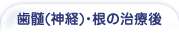 歯髄（神経）・根の治療後